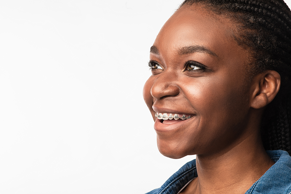 Girl With Dental Braces Smiling Looking Aside On White Background Ortodontia