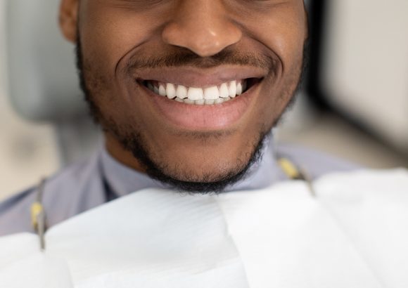 Unrecognizable Black Man Widely Smiling With His Perfect Healthy White Teeth, Closeup Oclusão e ATM