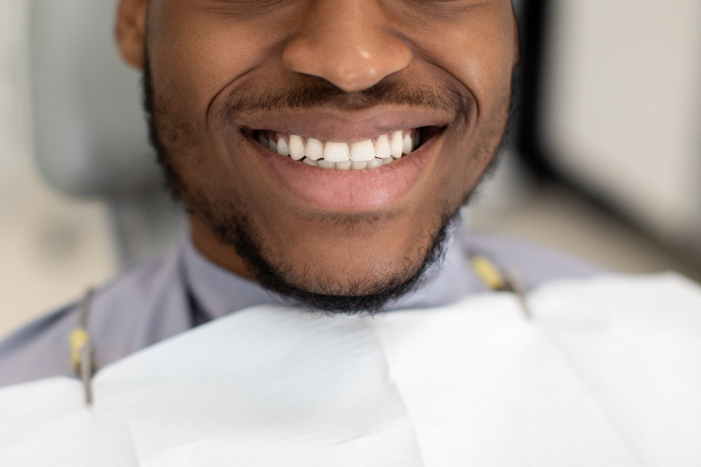 Unrecognizable Black Man Widely Smiling With His Perfect Healthy White Teeth, Closeup Oclusão e ATM