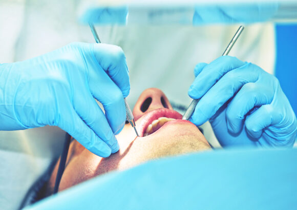 Cirurgia oral